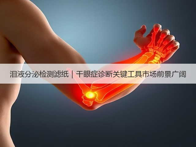 泪液分泌检测滤纸|干眼症诊断关键工具市场前景广阔(图2) 泪液分泌检测滤纸|干眼症诊断关键工具市场前景广阔(图2)