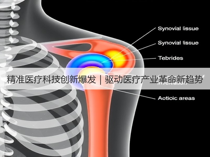 精准医疗科技创新爆发｜驱动医疗产业革命新趋势