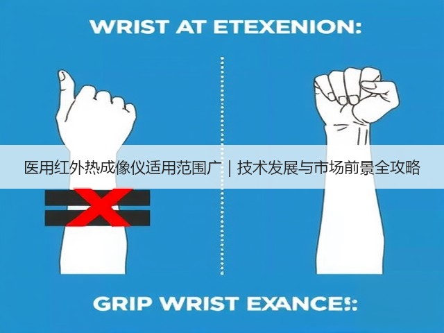 医用红外热成像仪适用范围广｜技术发展与市场前景全攻略(图1)