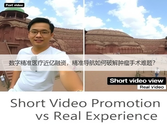 数字精准医疗近亿融资，精准导航如何破解肿瘤手术难题？(图3)