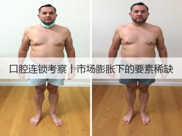 口腔连锁考察丨市场膨胀下的要素稀缺(图2) 口腔连锁考察丨市场膨胀下的要素稀缺(图2)