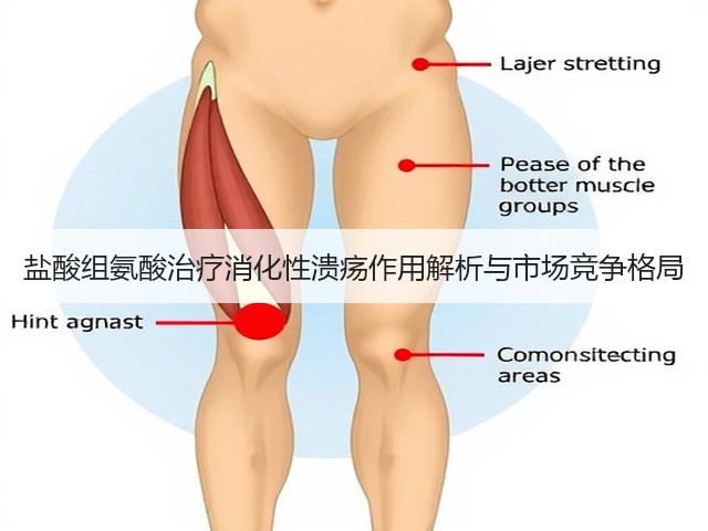 盐酸组氨酸治疗消化性溃疡作用解析与市场竞争格局(图1)