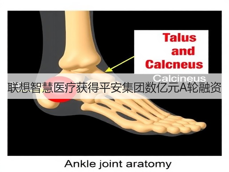 联想智慧医疗获得平安集团数亿元A轮融资