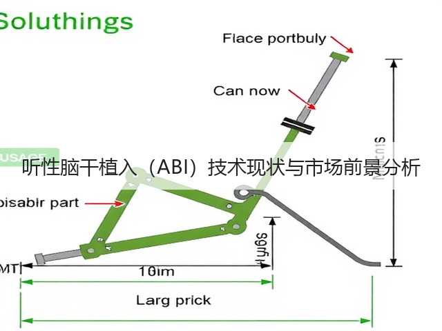 听性脑干植入（ABI）技术现状与市场前景分析(图1)