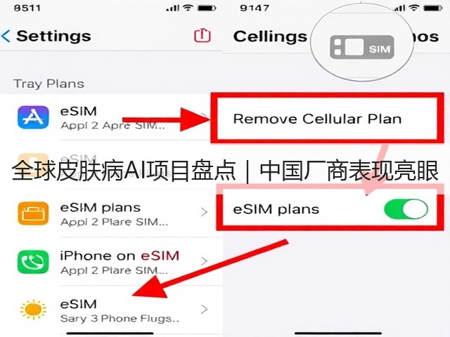 全球皮肤病AI项目盘点|中国厂商表现亮眼(图2) 全球皮肤病AI项目盘点|中国厂商表现亮眼(图2)