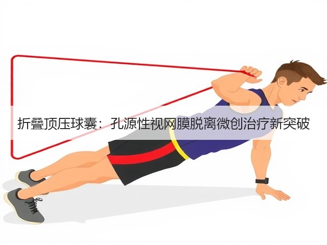 折叠顶压球囊：孔源性视网膜脱离微创治疗新突破(图3)